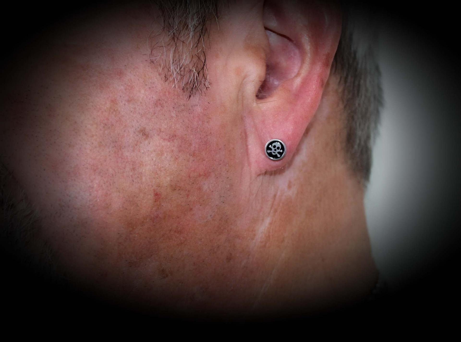 Fake Ear Plug Skull in Stainless Steel